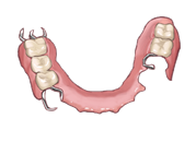 ２つ目は入れ歯です